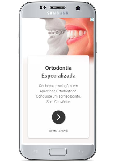 Imagem de celular mostrando Anúncio com Imagem no Google Ads para a Dental Butantã